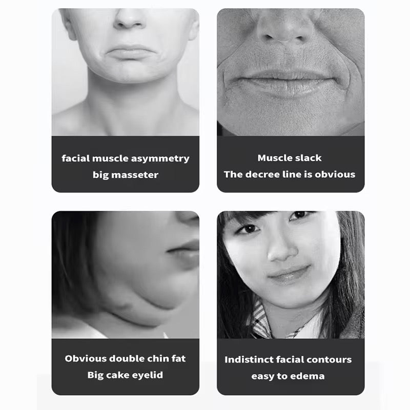 V-shaped Slimming Face Device Uses High-frequency Vibration to Tighten the Contour and Eliminate Double Chins