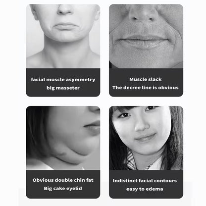 V-shaped Slimming Face Device Uses High-frequency Vibration to Tighten the Contour and Eliminate Double Chins