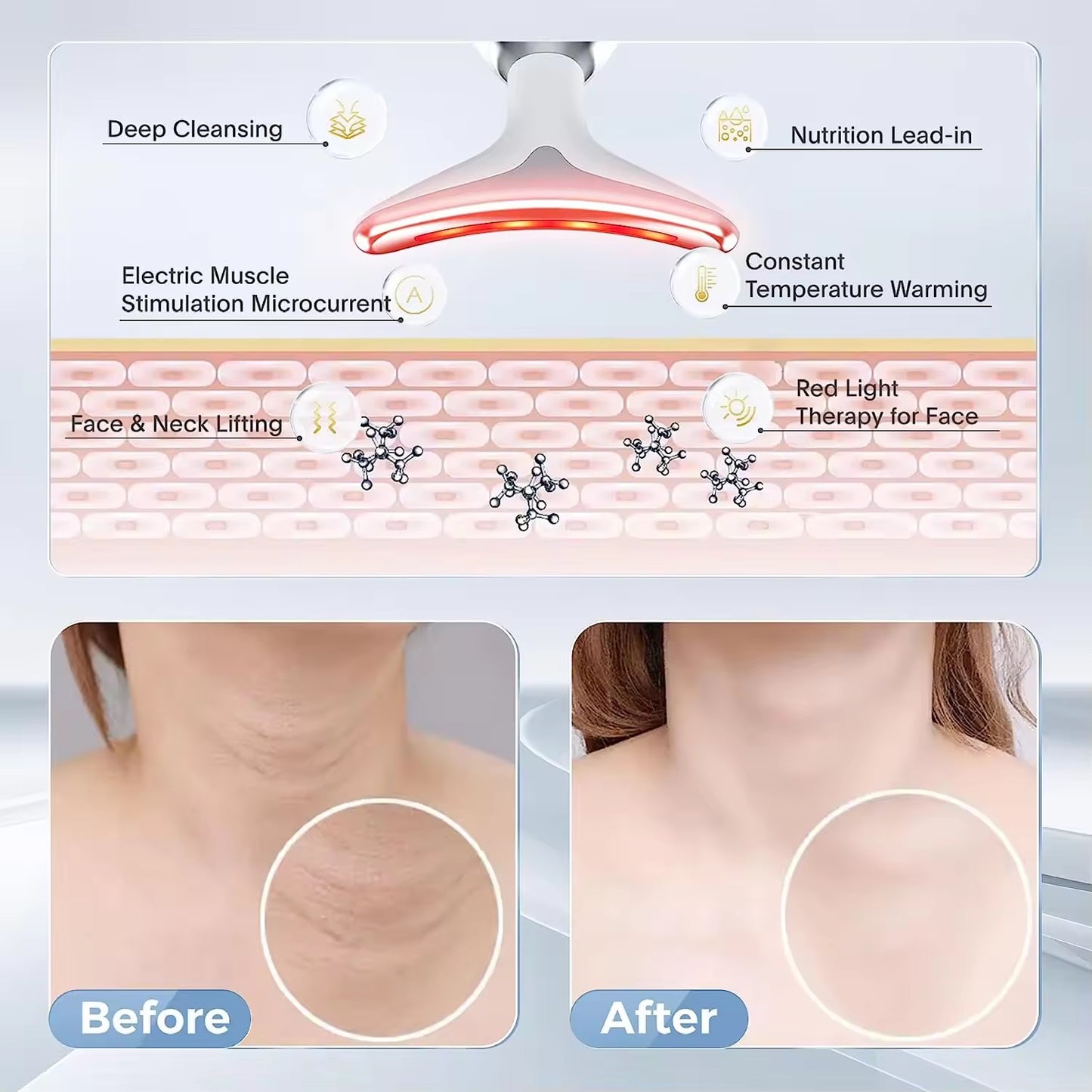 Wrinkle Remover, Pigment Removal, Skin Rejuvenation